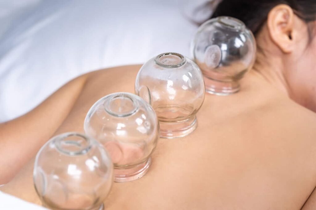 Cupping Light Massage RMT Clinic Toronto